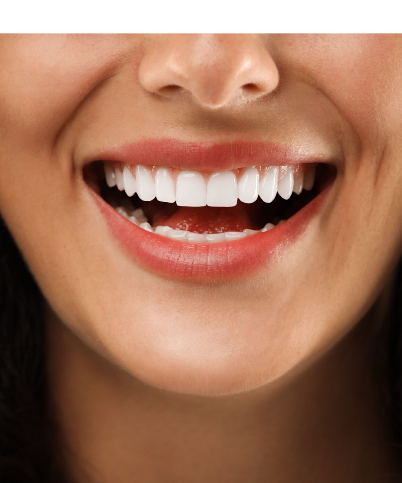 Dettaglio di un trattamento di estetica dentale allo studio Dental Design