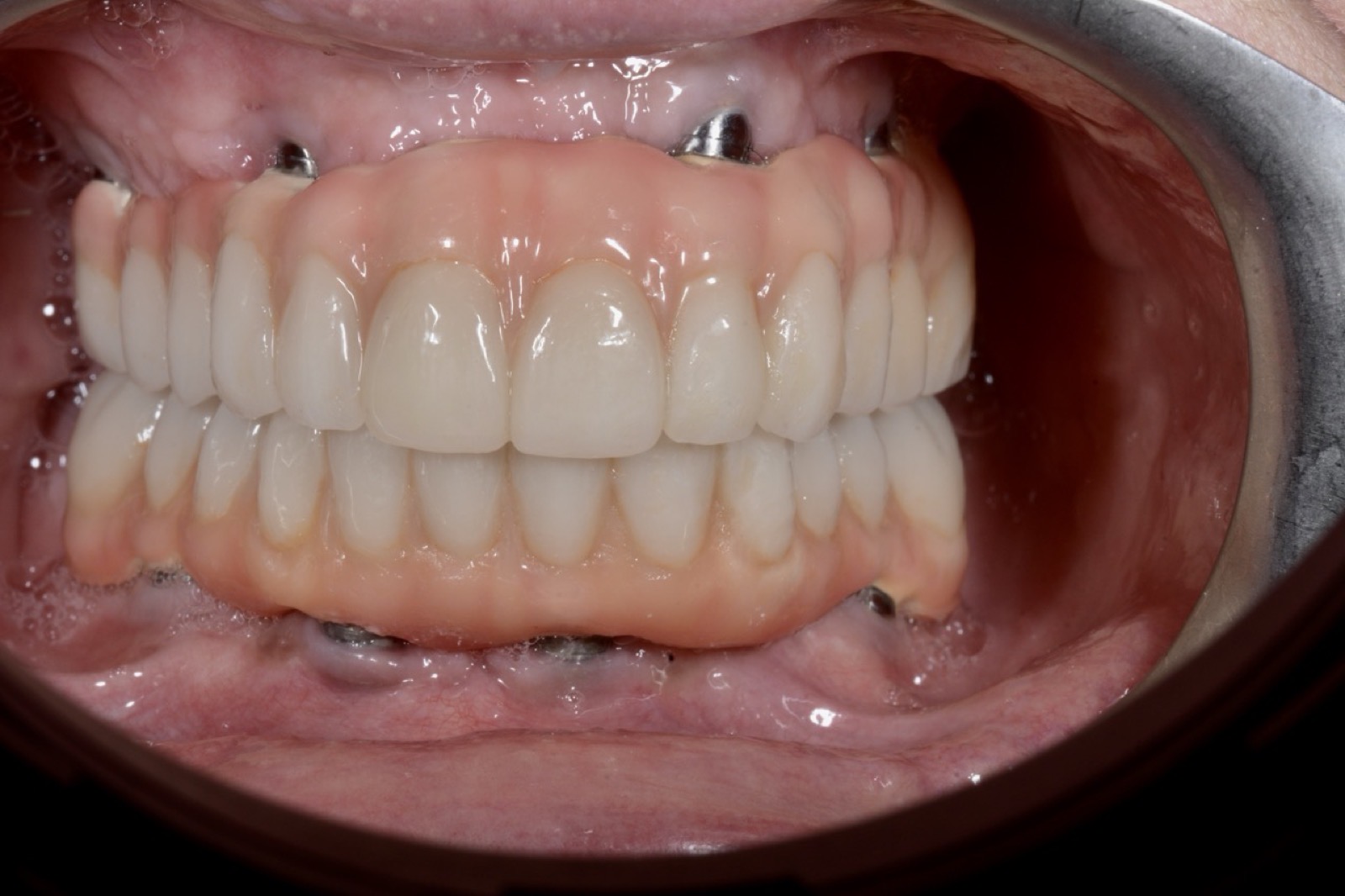 Sala operativa dello studio Dental Design attrezzata per la chirurgia implantare