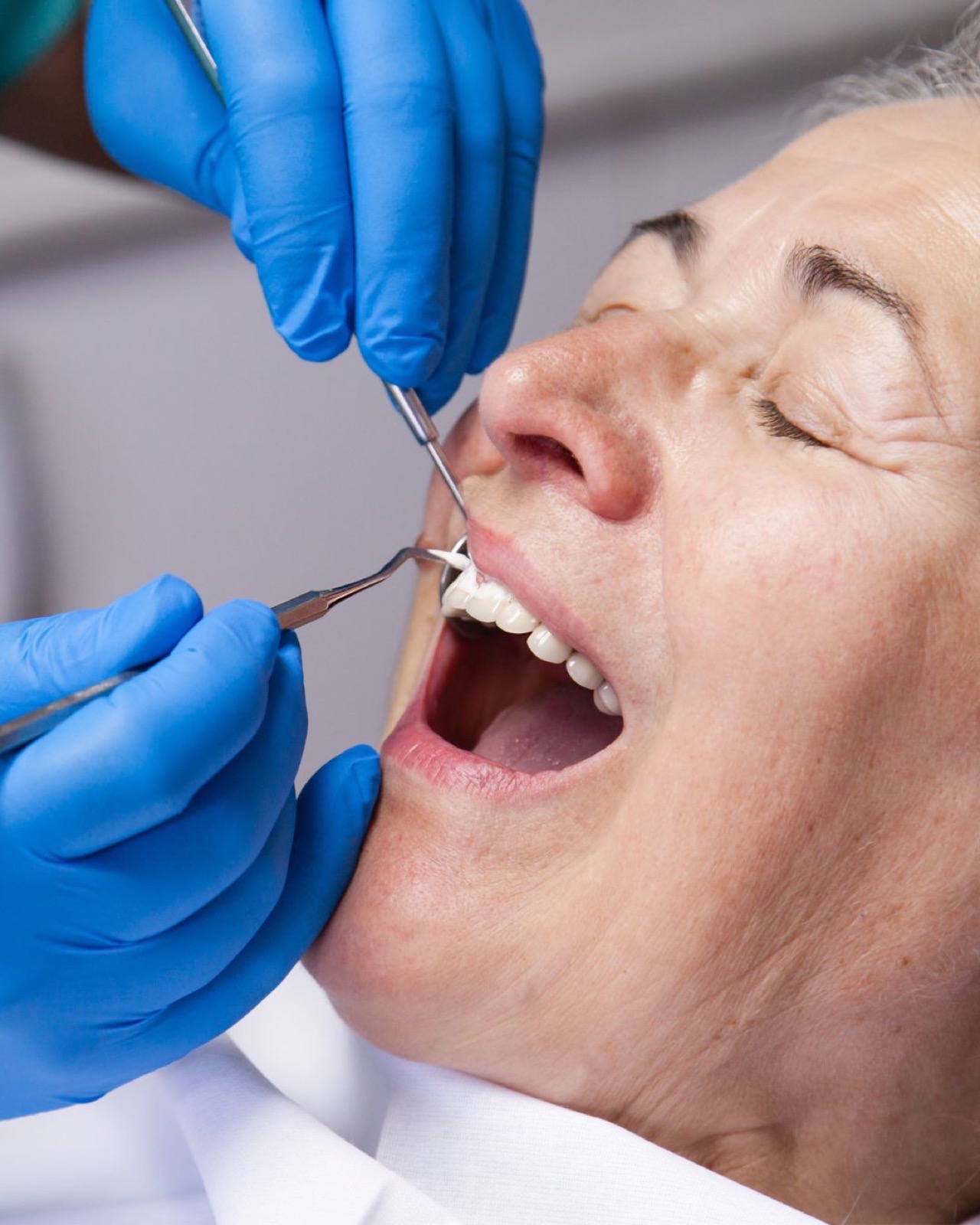Controllo parodontale allo studio Dental Design